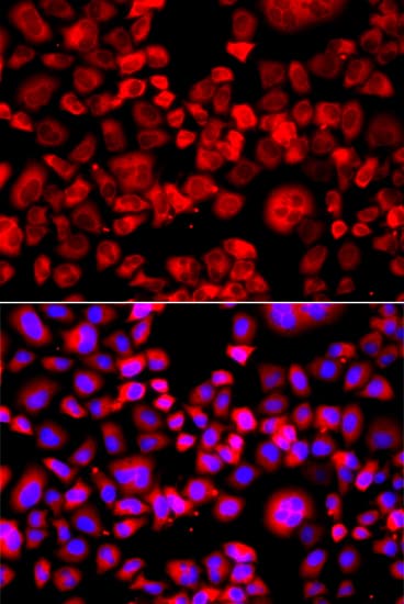 Polyclonal Rabbit anti-Human EIF4G1 / EIF4G Antibody (IHC, IF, WB)