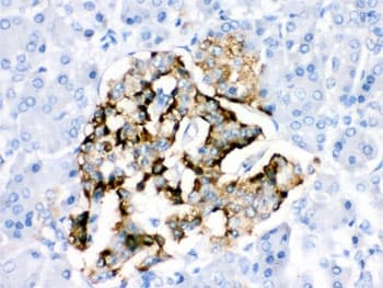 Polyclonal Rabbit anti-Human BAG2 Antibody (IHC, WB)