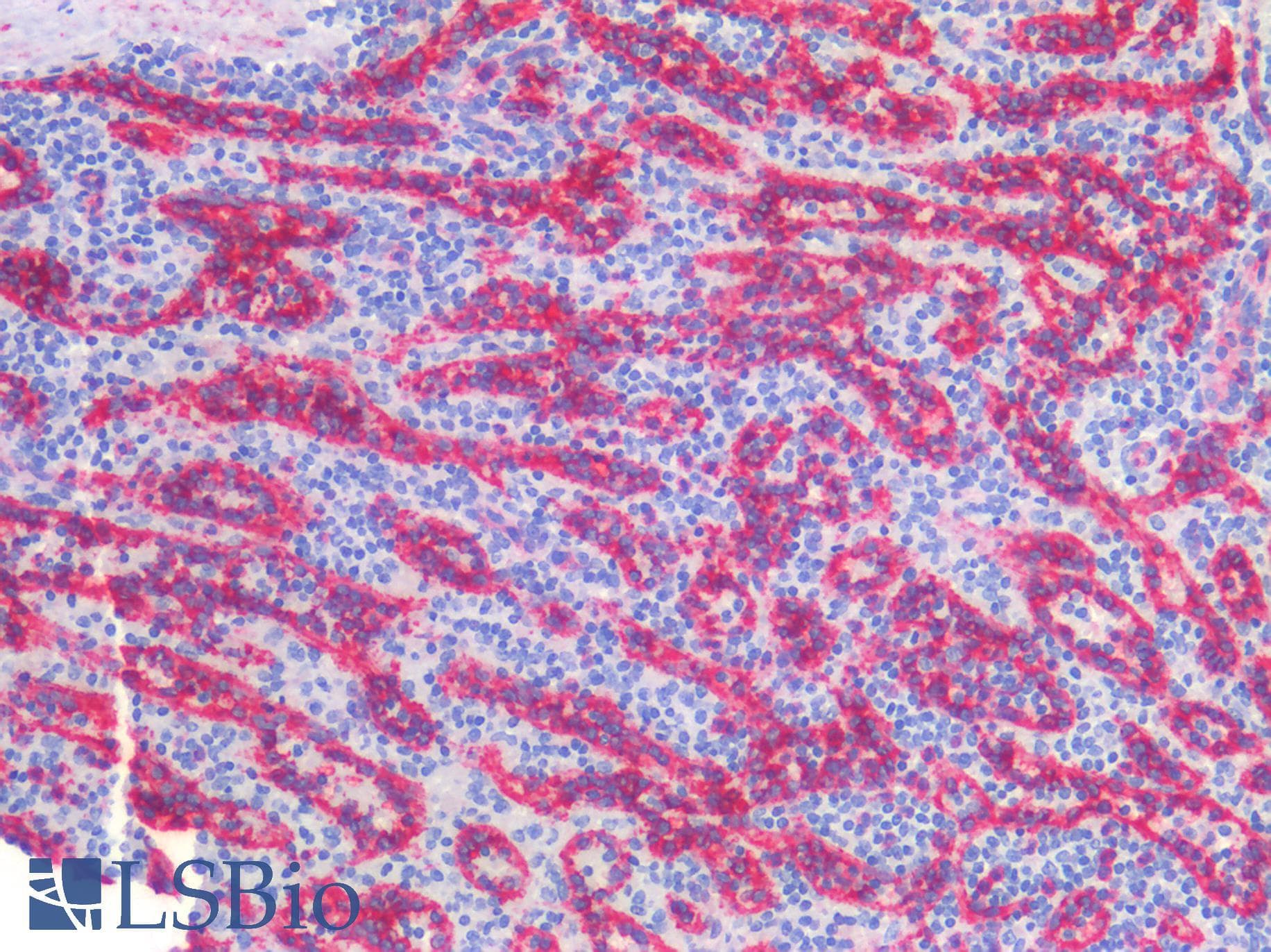 IHC-plus™ CAV1 / Caveolin 1 Antibody (C-Terminus)
