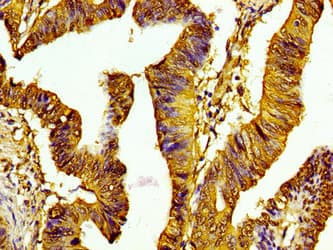 HIST1H1C Antibody