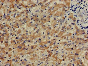 CTH / Cystathionase Antibody
