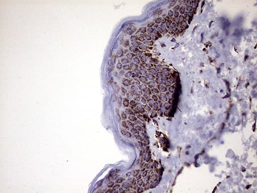 MLANA / Melan-A Antibody (aa48-118, clone OTI6G3)