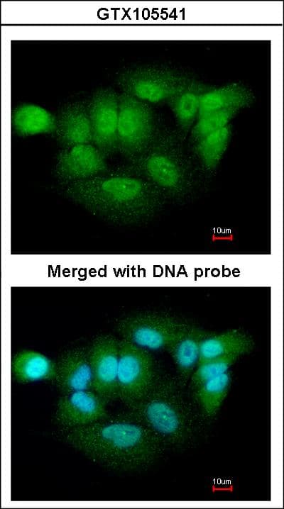 IHC-plus™ XPNPEP3 Antibody (aa12-507)