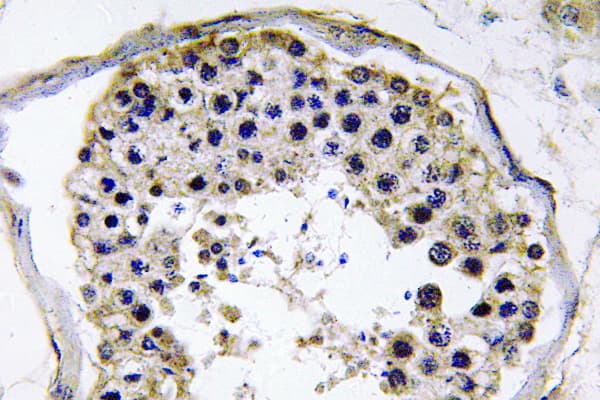TRAF6 Antibody (aa105-154)