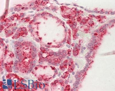 IHC-plus™ Polyclonal Rabbit anti-Human ATRIP Antibody (aa190-239, IHC, WB)
