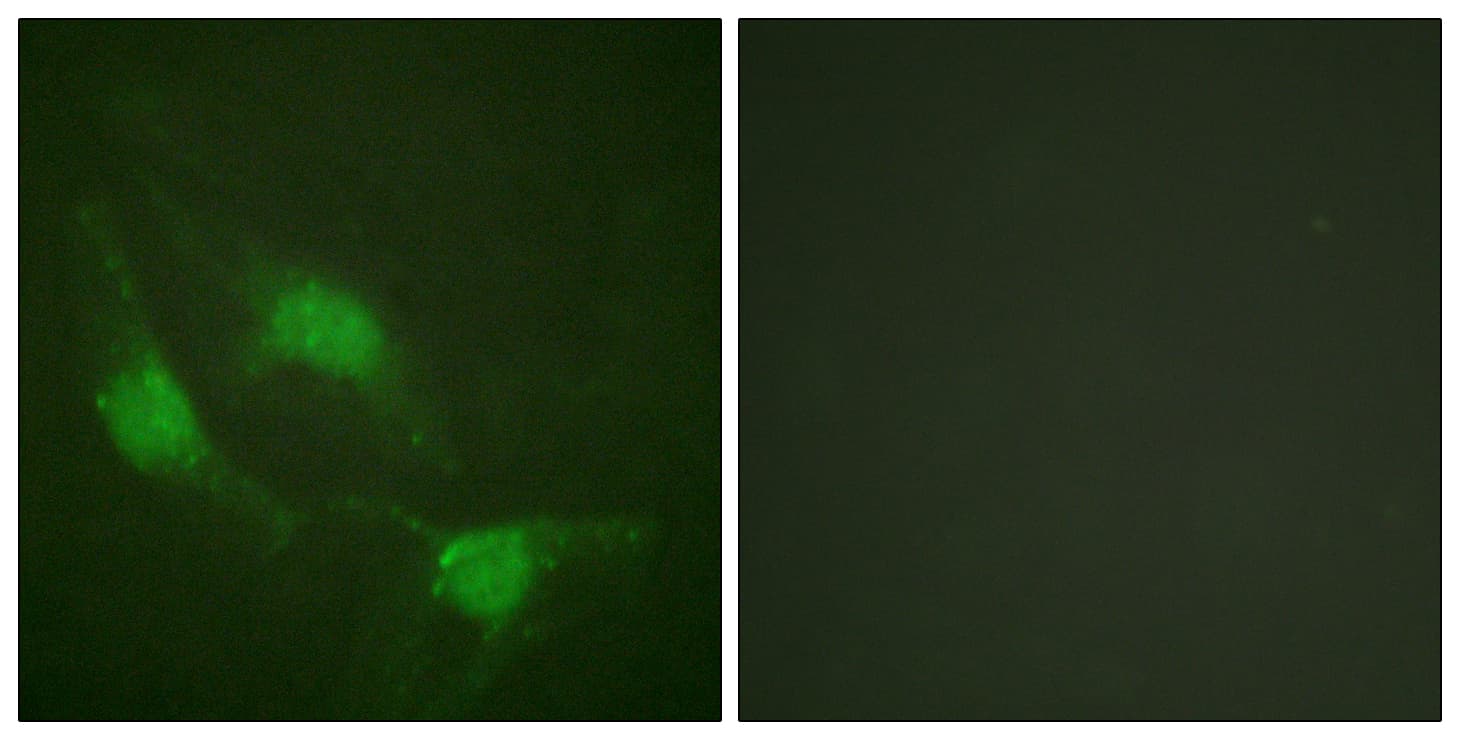 IHC-plus™ Polyclonal Rabbit anti-Human TP53 / p53 Antibody (aa344-393, IHC, IF, WB)