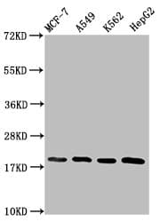 HIST1H1C Antibody