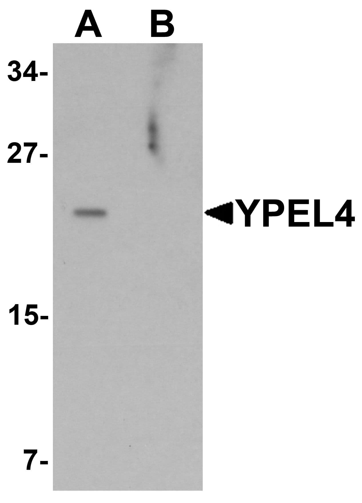 IHC-plus™ YPEL4 Antibody
