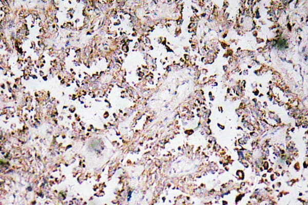VAMP1+2+3 Antibody (Asp70)