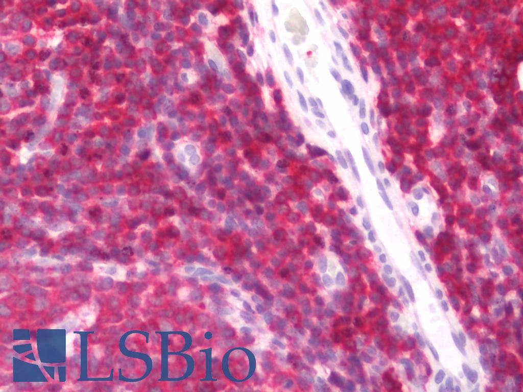 IHC-plus™ PINK1 Antibody