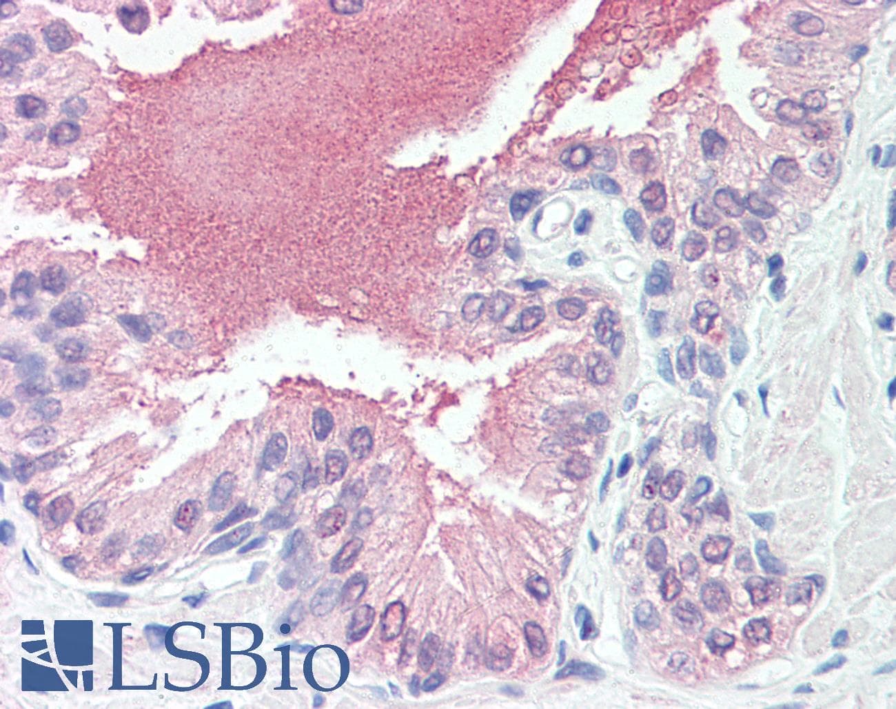 IHC-plus™ Polyclonal Rabbit anti-Human SLITRK6 Antibody (Cytoplasmic Domain, IHC)
