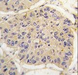 FKBP1A / FKBP12 Antibody (aa43-74)