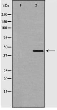 AURKA / Aurora-A Antibody