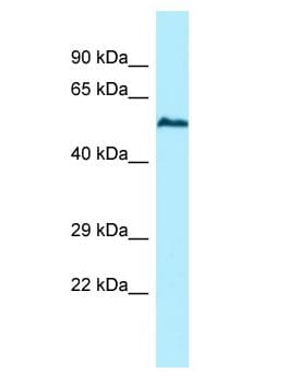 Polyclonal Rabbit anti-Human USP17L2 / DUB3 Antibody (aa481-530, WB)