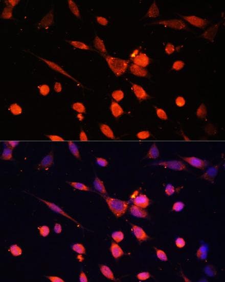 PIK3R3 / p85 Gamma Antibody