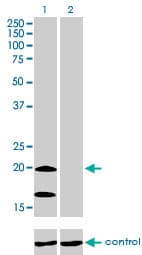Monoclonal Mouse anti-Human NDUFS4 Antibody (clone 1A1, IHC, WB)