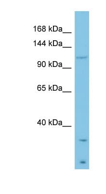 LAMB3 / Laminin Beta 3 Antibody (aa1079-1128)
