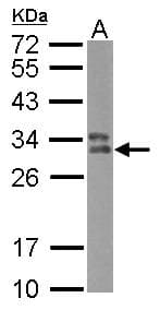 Polyclonal Rabbit anti-Human HLA-DPB1 Antibody (WB)