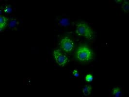 Monoclonal Mouse anti-Human NME4 Antibody (clone OTI1C11, IHC, IF, WB)