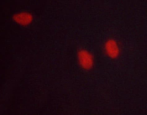 RELA / NFKB p65 Antibody