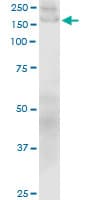 PathPlus™ Monoclonal Mouse anti-Human COL1A1 / Collagen I Alpha 1 Antibody (clone 3G3, IHC, WB)