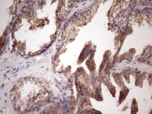 Monoclonal Mouse anti-Human BMF Antibody (clone OTI6F3, IHC, WB)