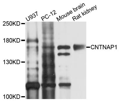 Polyclonal Rabbit anti-Human CNTNAP1 / CASPR / p190 Antibody (WB)
