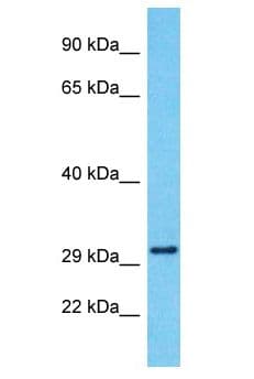 Polyclonal Rabbit anti-Human SERINC4 Antibody (aa127-176, WB)