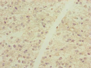 DYNC2LI1 / D2LIC Antibody