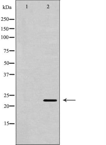 BAK1 / BAK Antibody