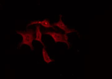 TH / Tyrosine Hydroxylase Antibody (phospho-Ser31)