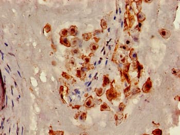 CAV2 / Caveolin 2 Antibody