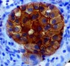 Recombinant Monoclonal Rabbit anti-Human NRAS / N-ras Antibody (clone RBT-NRAS, Q61R mutation, IHC)