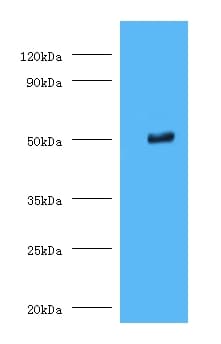 IHC-plus™ TMLHE / TMID Antibody (aa16-376)