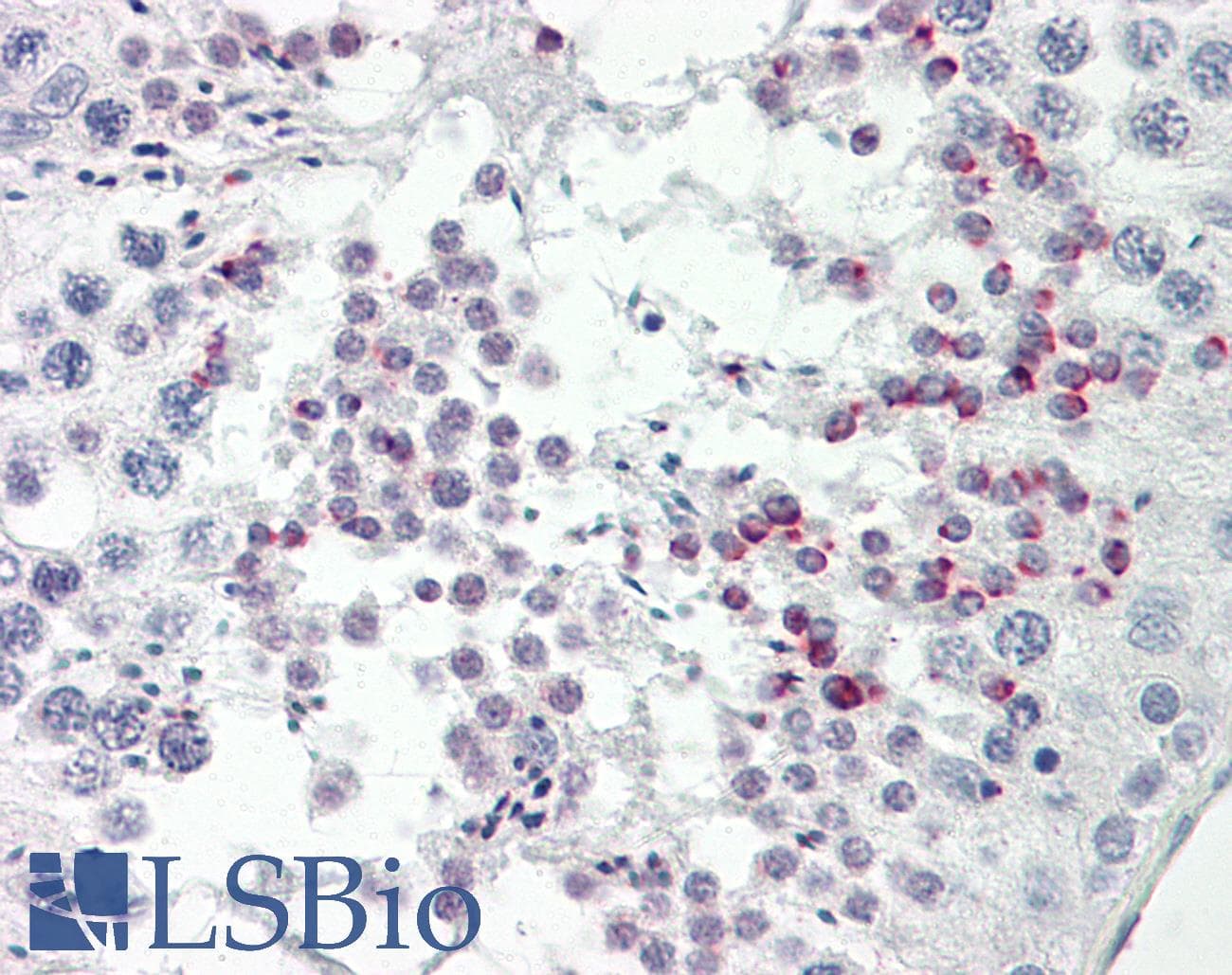 IHC-plus™ STK36 Antibody (aa387-436)