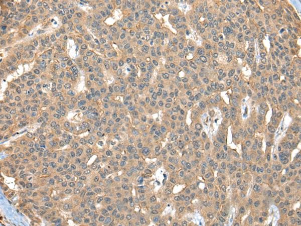 CA7 / Carbonic Anhydrase VII Antibody