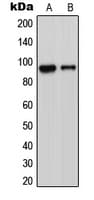 ADAM23 Antibody (C-Terminus)
