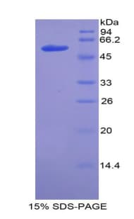 Mouse ACE / CD143 Protein (Recombinant His-MBP)
