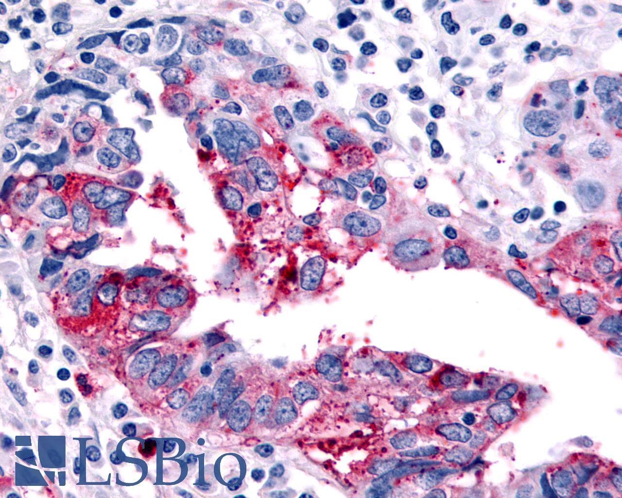 PathPlus™ HRH4 / Histamine H4 Receptor Antibody (Cytoplasmic Domain)