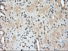TYRO3 Antibody (clone OTI4C8)