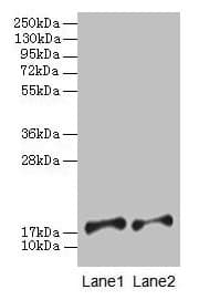 IHC-plus™ PFDN5 / MM1 Antibody