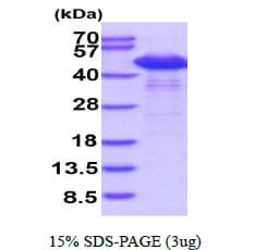 Human SET / TAF-I Protein (Recombinant His)