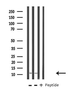 S100A10 Antibody