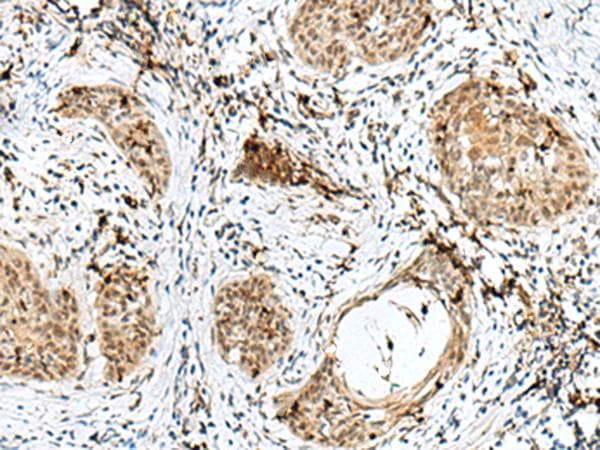 RBM15 Antibody