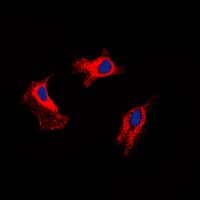 MMP9 / Gelatinase B Antibody (C-Terminus)