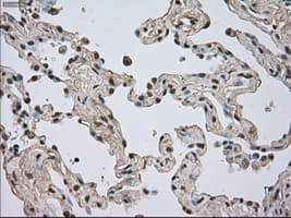 NTRK3 / TRKC Antibody (clone OTI2B8)
