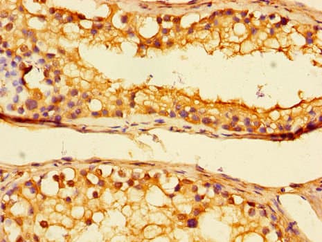 UBE1L2 / UBE1L2 Antibody