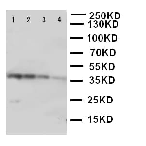 EIF2AK2 / PKR Antibody (aa2-18)
