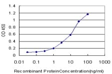 NDUFAB1 / ACP Antibody (clone 2D10)