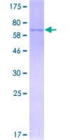 Human STYK1 Protein (Recombinant GST)